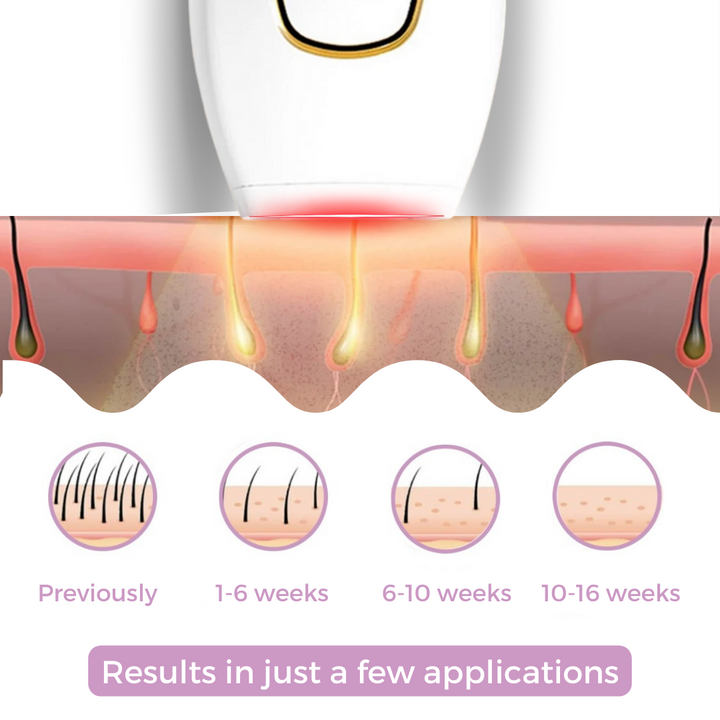 GLOWLUX | At-Home IPL Hair Removal Device