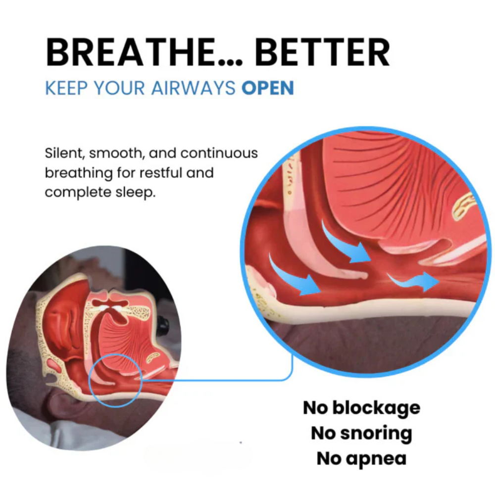 NEUROSLEEP | Smart Anti-Snoring Sleep Aid